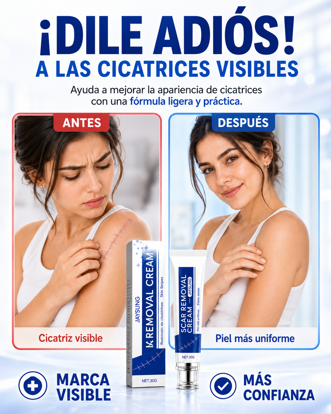 SCAR REMOVAL CREAM® - Crema para eliminar cicatrices✅