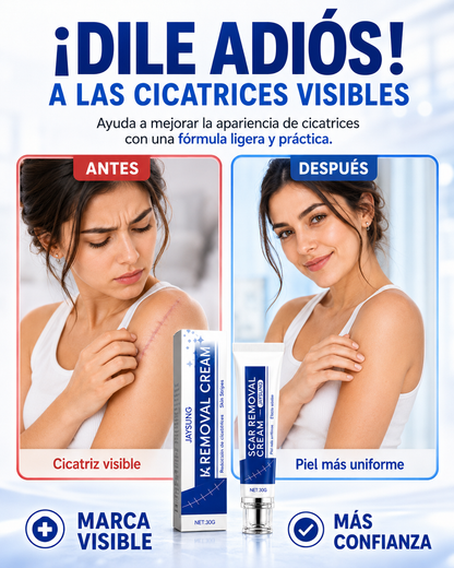 SCAR REMOVAL CREAM® - Crema para eliminar cicatrices✅