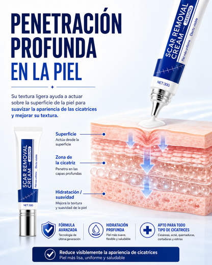 SCAR REMOVAL CREAM® - Crema para eliminar cicatrices✅