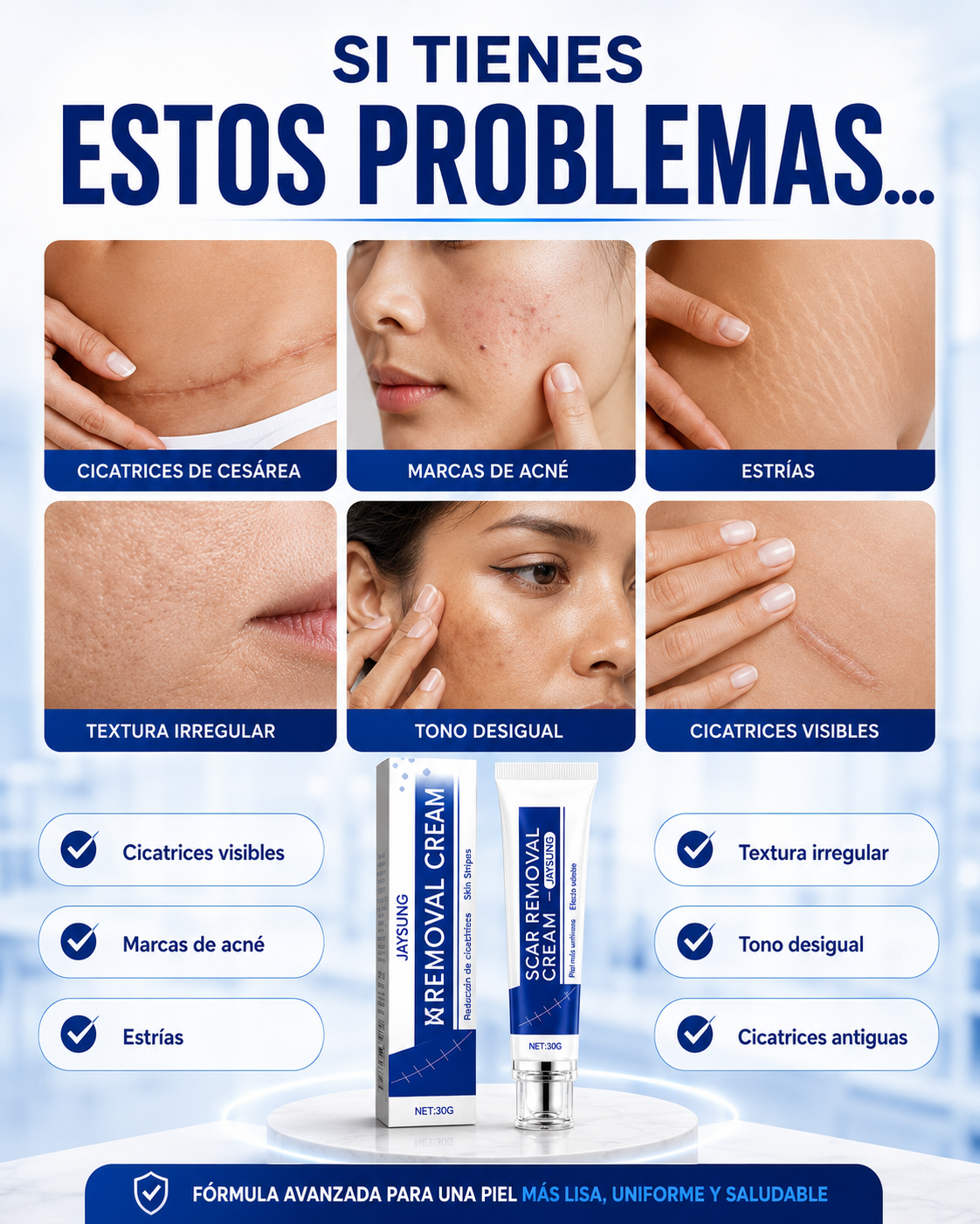 SCAR REMOVAL CREAM® - Crema para eliminar cicatrices✅
