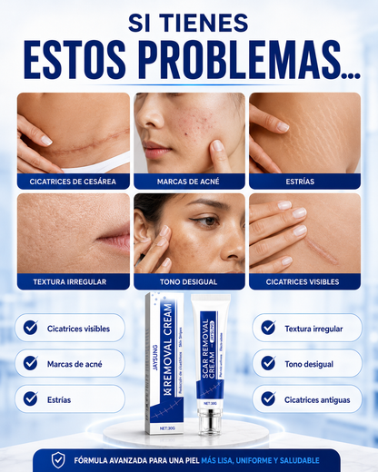 SCAR REMOVAL CREAM® - Crema para eliminar cicatrices✅
