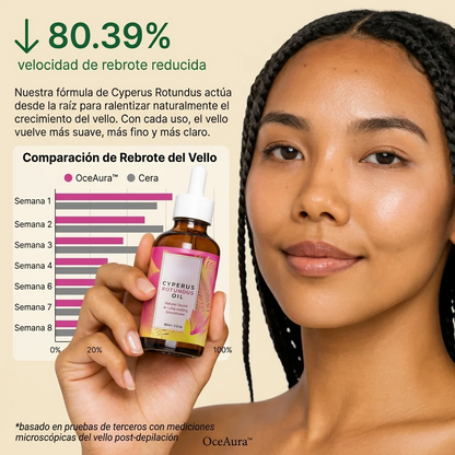 CYPERUS ROTUNDUS OIL® - Aceite de reducción de bellos🌸